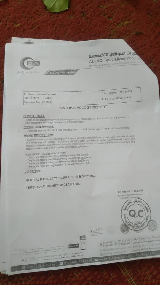 لحج.. أسرة من المسيمير تناشد اصحاب القلوب الرحيمة مساعدتها لإنقاذ حياة طفلتها المصابة بالسرطان لحج.. أسرة من المسيمير تناشد اصحاب القلوب الرحيمة مساعدتها لإنقاذ حياة طفلتها المصابة بالسرطان