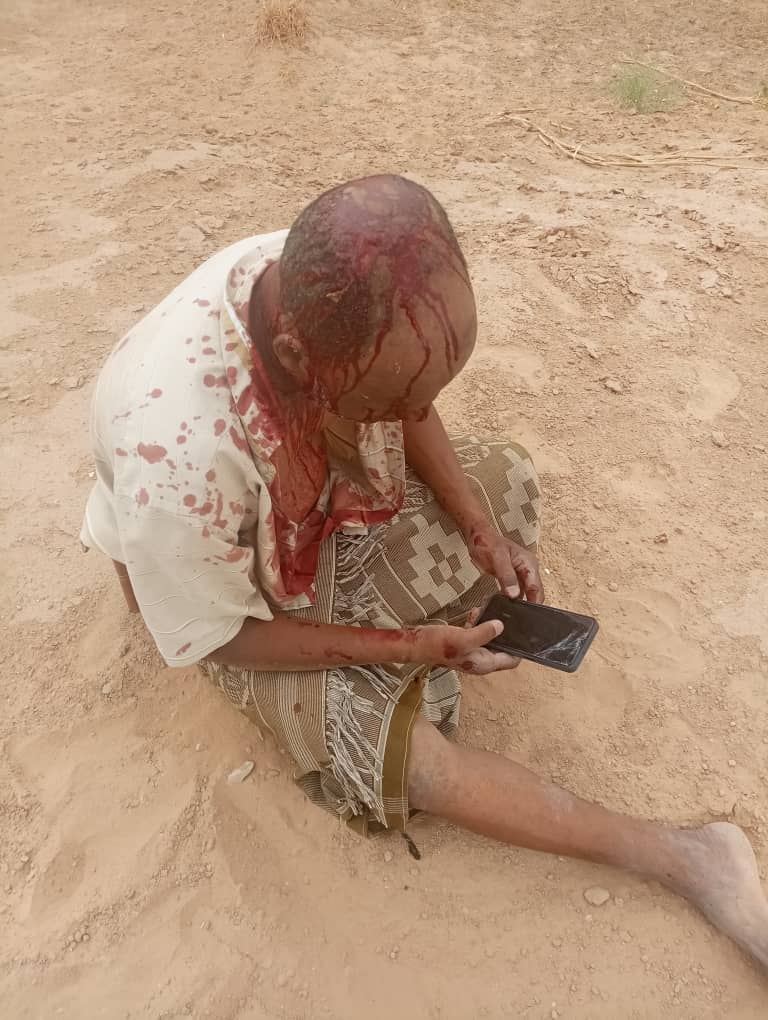 اعتداء بالضرب يتعرض له عضو الجمعية الوطنية للانتقالي بمديرية سيئون الاستاذ عبدالناصر مرجان اعتداء بالضرب يتعرض له عضو الجمعية الوطنية للانتقالي بمديرية سيئون الاستاذ عبدالناصر مرجان