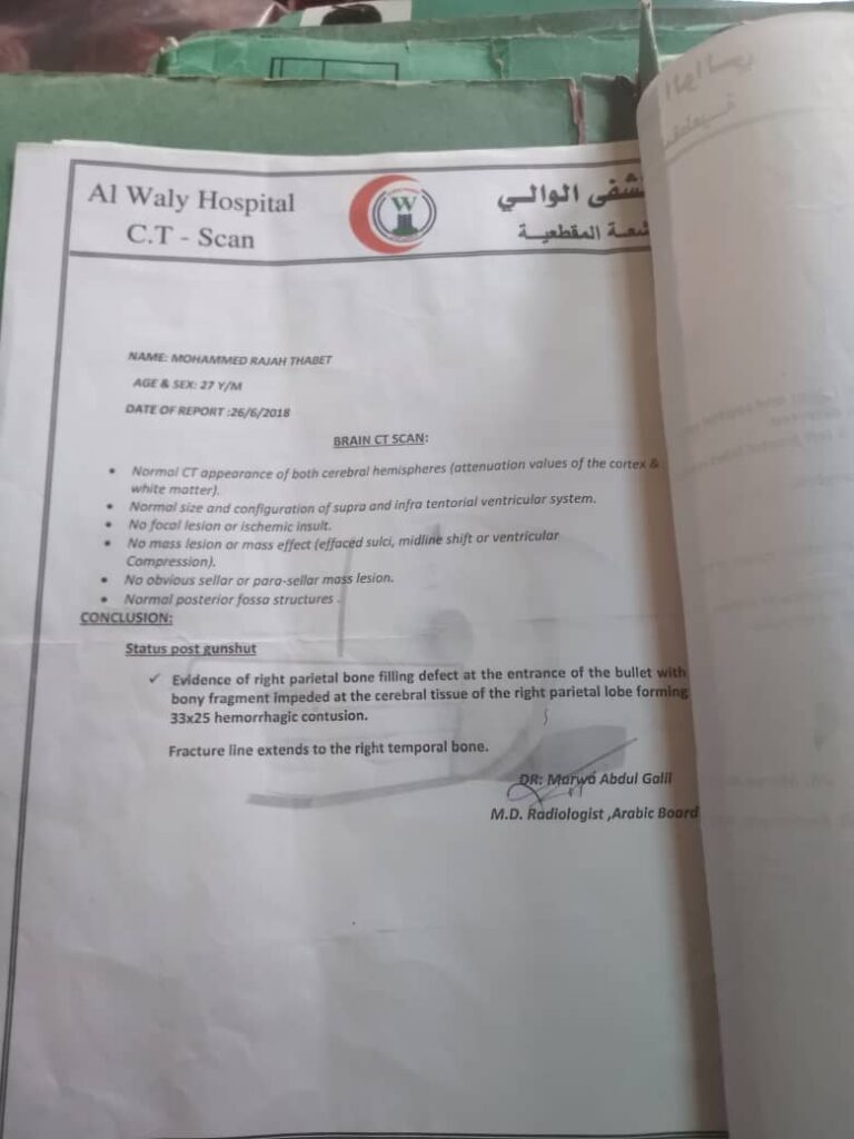 جريح حرب معاق يعلن بيع إحدى كليتيه ليواصل العلاج بعد تخلي الدولة عن معالجته جريح حرب معاق يعلن بيع إحدى كليتيه ليواصل العلاج بعد تخلي الدولة عن معالجته