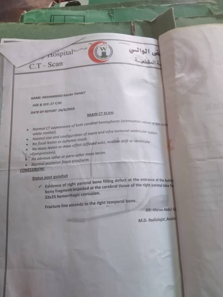 جريح حرب معاق يعلن بيع إحدى كليتيه ليواصل العلاج بعد تخلي الدولة عن معالجته جريح حرب معاق يعلن بيع إحدى كليتيه ليواصل العلاج بعد تخلي الدولة عن معالجته