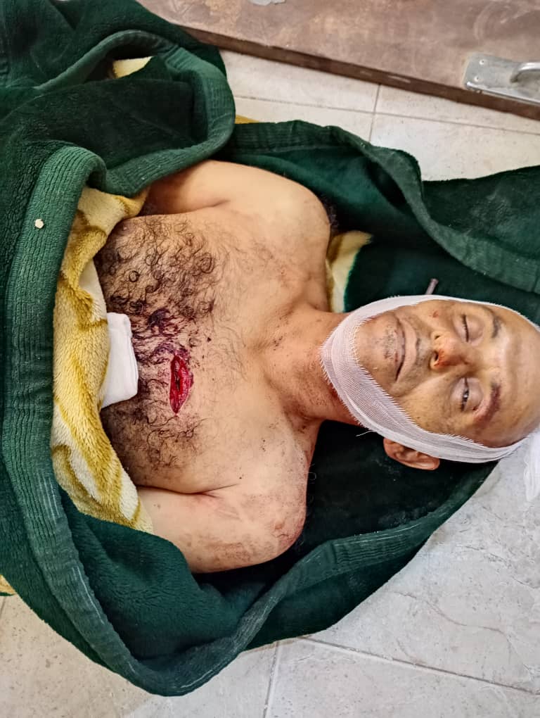 رجل مرور يلقى حتفه طعنا بجنبية على يد شاب في مدينة تريم رجل مرور يلقى حتفه طعنا بجنبية على يد شاب في مدينة تريم