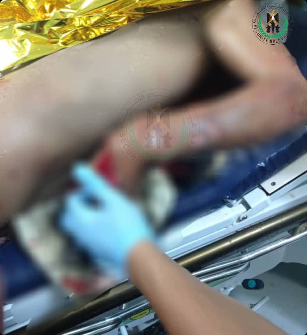 الحزام الأمني يكشف تفاصيل انفجار الدراجة النارية في الضالع - الحزام الأمني يكشف تفاصيل انفجار الدراجة النارية في الضالع -