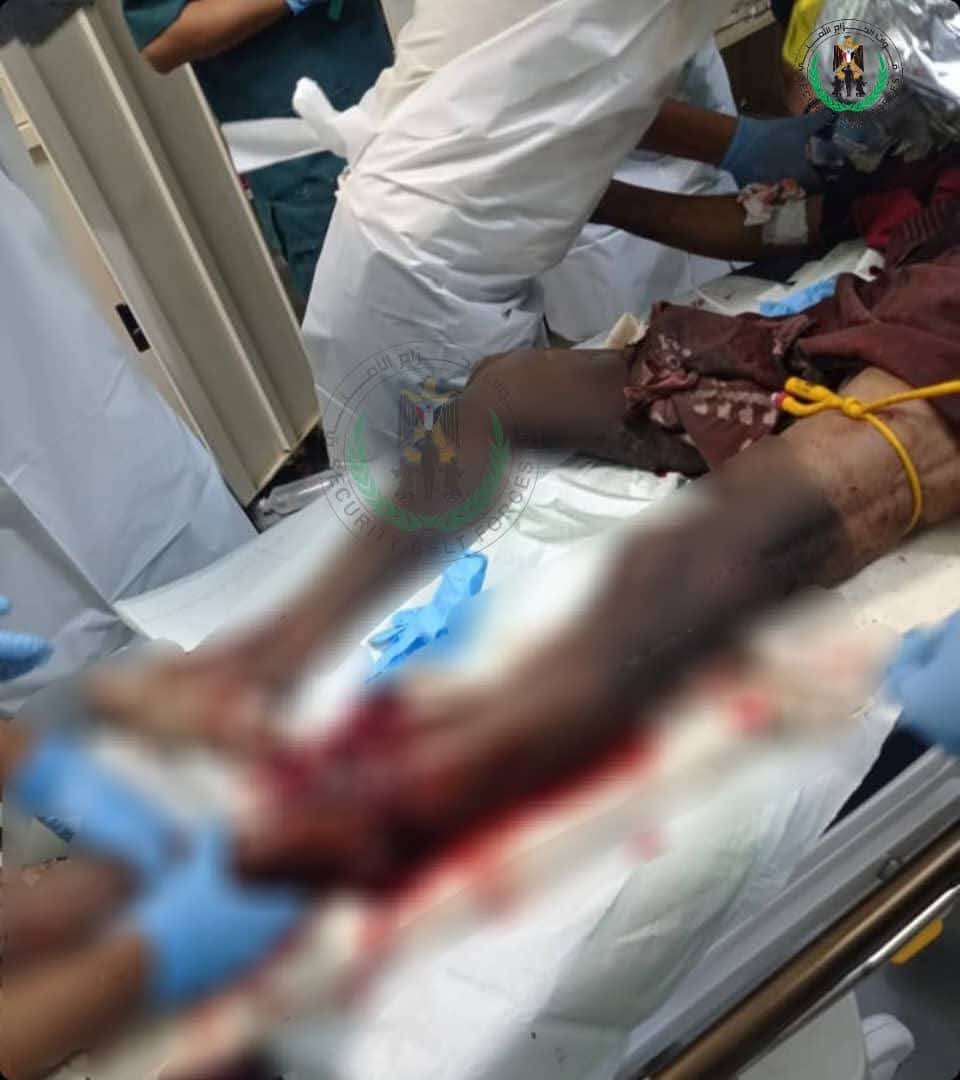الحزام الأمني يكشف تفاصيل انفجار الدراجة النارية في الضالع - الحزام الأمني يكشف تفاصيل انفجار الدراجة النارية في الضالع -