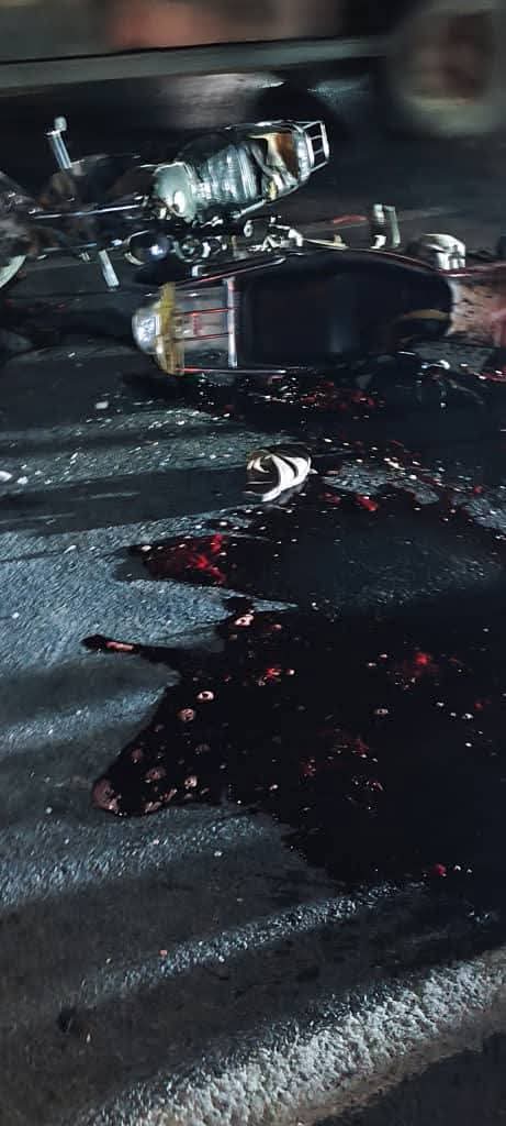 مصرع شاب وإصابة اثنين آخرين في حادث تصادم دراجتين ناريتين شرق "شاهد الصور" مصرع شاب وإصابة اثنين آخرين في حادث تصادم دراجتين ناريتين شرق "شاهد الصور"