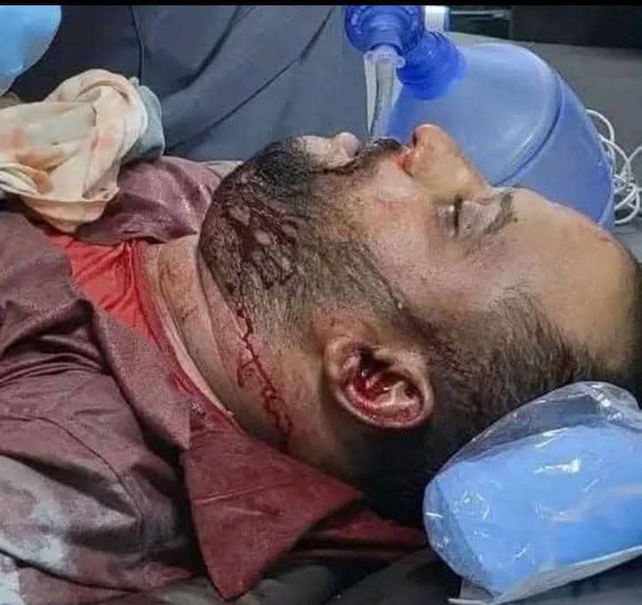 شبوة تحيي الذكرى الـ59 ليوم الشهيد الجنوبي بحشد جماهيري في عتق وتؤكد ثباتها على تفويضها للرئيس الزُبيدي(بيان) - شبوة تحيي الذكرى الـ59 ليوم الشهيد الجنوبي بحشد جماهيري في عتق وتؤكد ثباتها على تفويضها للرئيس الزُبيدي(بيان) -