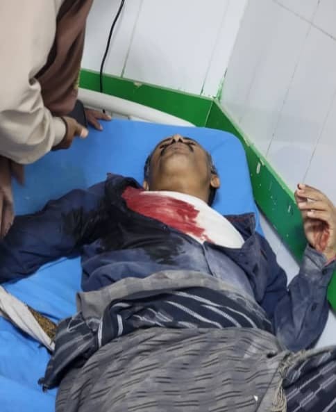 استشهاد وإصابة العشرات من أبناء المحافظة باعتداء قوات امنية على الحشد .. شبوة تحيي الذكرى الـ59 ليوم الشهيد الجنوبي بحشد جماهيري في عتق وتؤكد ثباتها على تفويضها للرئيس الزُبيدي(بيان) استشهاد وإصابة العشرات من أبناء المحافظة باعتداء قوات امنية على الحشد .. شبوة تحيي الذكرى الـ59 ليوم الشهيد الجنوبي بحشد جماهيري في عتق وتؤكد ثباتها على تفويضها للرئيس الزُبيدي(بيان)