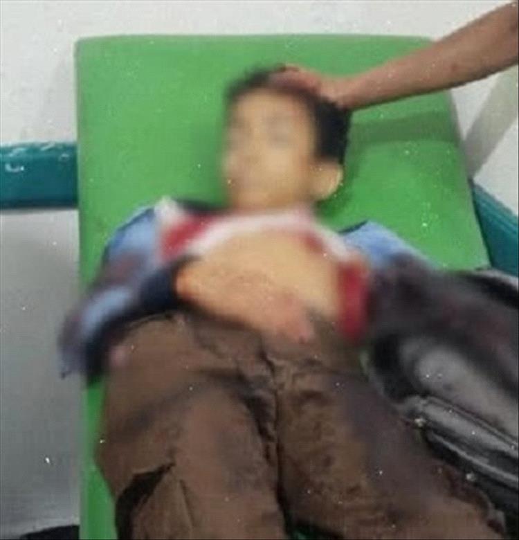 مقـ,ـتل طفل برصـ,ـاص قناص حـ,ـوثي أثناء عودته من المدرسة شمالي تعز مقـ,ـتل طفل برصـ,ـاص قناص حـ,ـوثي أثناء عودته من المدرسة شمالي تعز