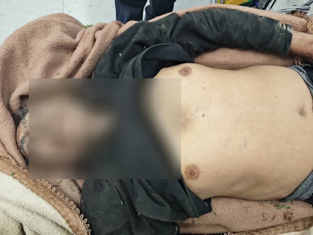 مقتل مسن برصاص قنّاص حوثي في تعز مقتل مسن برصاص قنّاص حوثي في تعز