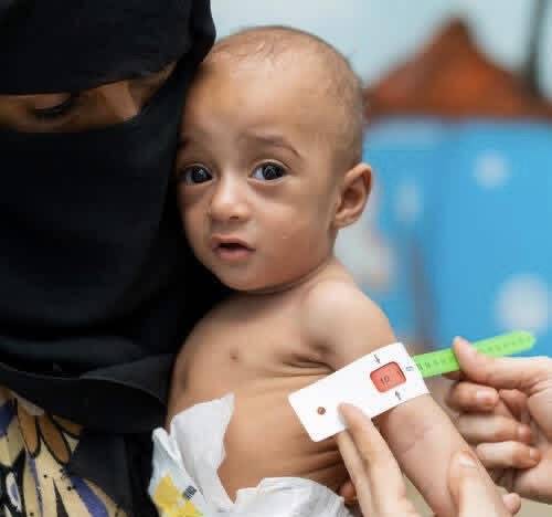 الحوثيون يقايضون اللقاحات بعودة مكاتب الأمم المتحدة الحوثيون يقايضون اللقاحات بعودة مكاتب الأمم المتحدة