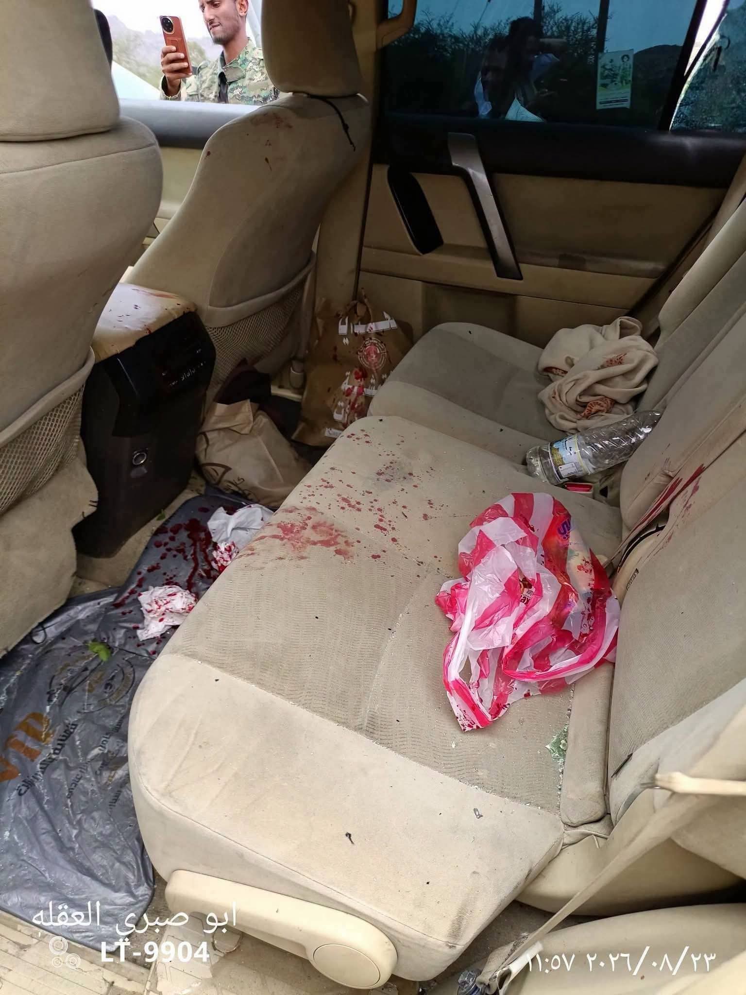 قصف حوثي يستهدف مدنيين على خط مريس–دمت ويصيب أكثر من 3 أشخاص - قصف حوثي يستهدف مدنيين على خط مريس–دمت ويصيب أكثر من 3 أشخاص -